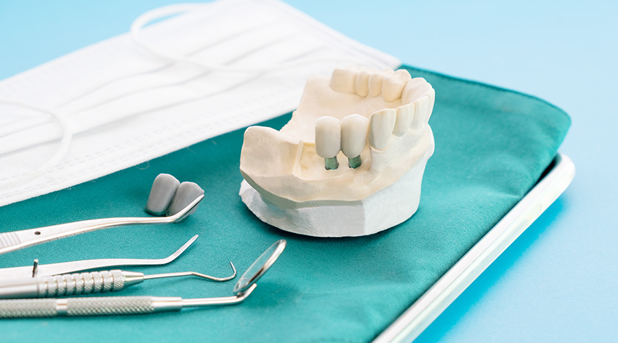 虫歯についてgeneral dentistry